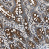 Anti-ACBD3 antibody produced in rabbit Prestige Antibodies® Powered by Atlas Antibodies, affinity isolated antibody, buffered aqueous glycerol solution
