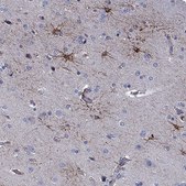 Anti-CLIP3 antibody produced in rabbit Prestige Antibodies® Powered by Atlas Antibodies, affinity isolated antibody, buffered aqueous glycerol solution