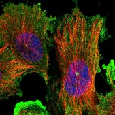 Anti-DIS3L antibody produced in rabbit Prestige Antibodies® Powered by Atlas Antibodies, affinity isolated antibody, buffered aqueous glycerol solution