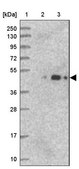 Anti-ARMC6 antibody produced in rabbit Prestige Antibodies® Powered by Atlas Antibodies, affinity isolated antibody, buffered aqueous glycerol solution