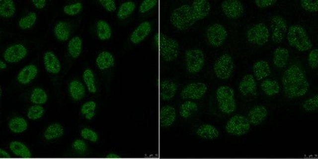 Anti-ARID1B Antibody, clone 3D9.1 clone 3D9.1, from mouse