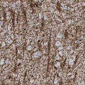 Anti-CNP antibody produced in rabbit Prestige Antibodies® Powered by Atlas Antibodies, affinity isolated antibody, buffered aqueous glycerol solution, Ab1
