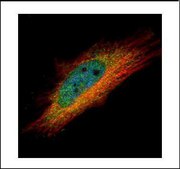 Anti-IP6K1 antibody produced in rabbit