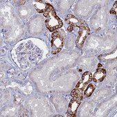 Anti-FAM159A antibody produced in rabbit Prestige Antibodies® Powered by Atlas Antibodies, affinity isolated antibody, buffered aqueous glycerol solution