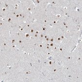 Anti-WRNIP1 antibody produced in rabbit Prestige Antibodies® Powered by Atlas Antibodies, affinity isolated antibody, buffered aqueous glycerol solution