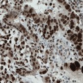 Monoclonal Anti-NSD2 antibody produced in mouse Prestige Antibodies® Powered by Atlas Antibodies, clone CL1057, purified immunoglobulin, buffered aqueous glycerol solution