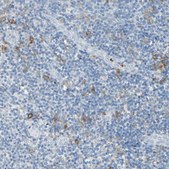 Anti-CLEC4A antibody produced in rabbit Prestige Antibodies® Powered by Atlas Antibodies, affinity isolated antibody, buffered aqueous glycerol solution
