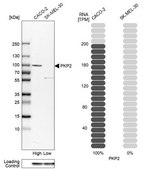 Anti-PKP2 antibody produced in rabbit Prestige Antibodies® Powered by Atlas Antibodies, affinity isolated antibody, buffered aqueous glycerol solution