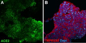 3dGRO® Lung Organoid Maturation Medium Serum-free ready-to-use media used to differentiate lung bud organoids (LBOs) into mature branching lung organoids.