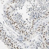 Anti-CCNT1 antibody produced in rabbit Prestige Antibodies® Powered by Atlas Antibodies, affinity isolated antibody, buffered aqueous glycerol solution