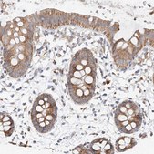 Anti-MRPL24 antibody produced in rabbit Prestige Antibodies® Powered by Atlas Antibodies, affinity isolated antibody, buffered aqueous glycerol solution