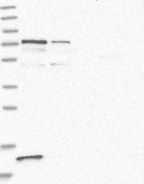 Anti-PPP2R3B antibody produced in rabbit Prestige Antibodies® Powered by Atlas Antibodies, affinity isolated antibody, buffered aqueous glycerol solution