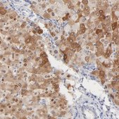 Anti-ONECUT1 antibody produced in rabbit Prestige Antibodies® Powered by Atlas Antibodies, affinity isolated antibody, buffered aqueous glycerol solution