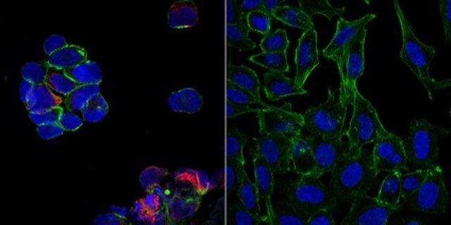 Sheep Anti-Human IgG Antibody, Cy5 conjugate from sheep, CY5 conjugate
