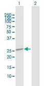 Anti-OTUB2 antibody produced in rabbit purified immunoglobulin, buffered aqueous solution