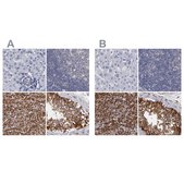 Anti-SLMAP antibody produced in rabbit Ab1, Prestige Antibodies® Powered by Atlas Antibodies, affinity isolated antibody, buffered aqueous glycerol solution