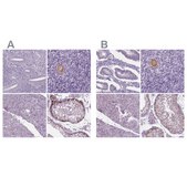 Anti-IGF2BP1 antibody produced in rabbit Prestige Antibodies® Powered by Atlas Antibodies, affinity isolated antibody, buffered aqueous glycerol solution