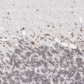Anti-TFAP4 antibody produced in rabbit Prestige Antibodies® Powered by Atlas Antibodies, affinity isolated antibody, buffered aqueous glycerol solution