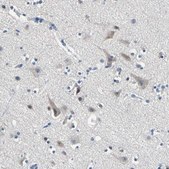 Anti-SELENOK antibody produced in rabbit Prestige Antibodies® Powered by Atlas Antibodies, affinity isolated antibody, buffered aqueous glycerol solution