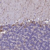 Anti-GFAP antibody produced in rabbit Prestige Antibodies® Powered by Atlas Antibodies, affinity isolated antibody, buffered aqueous glycerol solution