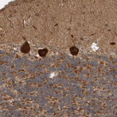 Anti-BAIAP2 antibody produced in rabbit affinity isolated antibody, buffered aqueous glycerol solution