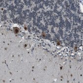 Anti-SRPK2 antibody produced in rabbit Prestige Antibodies® Powered by Atlas Antibodies, affinity isolated antibody, buffered aqueous glycerol solution