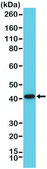 Anti-p504s/AMACR antibody, Rabbit monoclonal recombinant, expressed in HEK 293 cells, clone RM349, purified immunoglobulin
