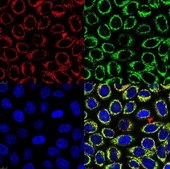 BioTracker ATP-Red生細胞色素 Live cell imaging dye for cellular adenosine triphosphate (ATP) localized to mitochondria used to detect metabolic activity, cell proliferation and overall cell health.
