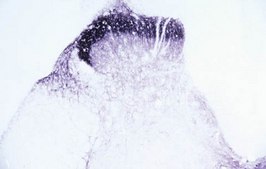 Anti-Vanilloid Receptor Like Protein Antibody, pain, CT Chemicon®, from rabbit