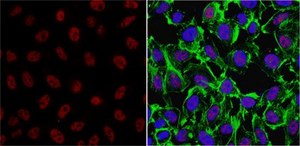 Anti-TAF10/TAFII30 Antibody, clone 6TA-2B11 ascites fluid, clone 6TA-2B11, from mouse