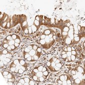 Anti-PTPN22 antibody produced in rabbit Prestige Antibodies® Powered by Atlas Antibodies, affinity isolated antibody, buffered aqueous glycerol solution, ab1