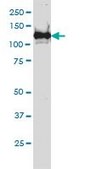 Monoclonal Anti-BUB1B antibody produced in mouse clone 3F2, purified immunoglobulin, buffered aqueous solution