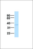 Anti-ELOVL5 antibody produced in rabbit affinity isolated antibody