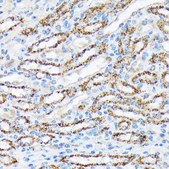 Anti-p70 S6 Kinase 2 antibody produced in rabbit