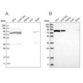 Anti-ABCF2 antibody produced in rabbit Prestige Antibodies® Powered by Atlas Antibodies, affinity isolated antibody, buffered aqueous glycerol solution, Ab1