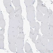 Anti-PSD4 antibody produced in rabbit Prestige Antibodies® Powered by Atlas Antibodies, affinity isolated antibody, buffered aqueous glycerol solution