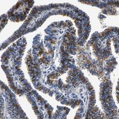 Anti-PSPH antibody produced in rabbit Prestige Antibodies® Powered by Atlas Antibodies, affinity isolated antibody, buffered aqueous glycerol solution