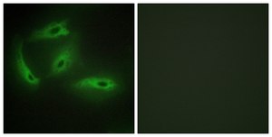 Anti-CDKL4 antibody produced in rabbit affinity isolated antibody