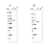 Anti-ACSL1 antibody produced in rabbit Prestige Antibodies® Powered by Atlas Antibodies, affinity isolated antibody, buffered aqueous glycerol solution