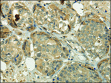 Anti-SIAH1 affinity isolated antibody