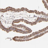 Anti-RPS20 antibody produced in rabbit Prestige Antibodies® Powered by Atlas Antibodies, affinity isolated antibody, buffered aqueous glycerol solution