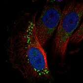 Anti-GARNL3 antibody produced in rabbit Prestige Antibodies® Powered by Atlas Antibodies, affinity isolated antibody, buffered aqueous glycerol solution