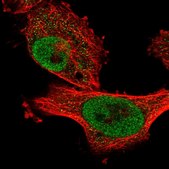 Anti-ANKRD49 antibody produced in rabbit Prestige Antibodies® Powered by Atlas Antibodies, affinity isolated antibody, buffered aqueous glycerol solution