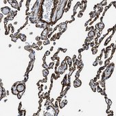 Anti-NAB1 antibody produced in rabbit Prestige Antibodies® Powered by Atlas Antibodies, affinity isolated antibody, buffered aqueous glycerol solution