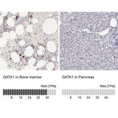 Anti-GATA1 antibody produced in rabbit Prestige Antibodies® Powered by Atlas Antibodies, affinity isolated antibody, buffered aqueous glycerol solution