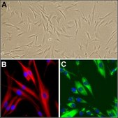 Human Dermal Fibroblasts: HDF, neonatal