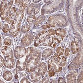 Anti-FUNDC1 antibody produced in rabbit Prestige Antibodies® Powered by Atlas Antibodies, affinity isolated antibody, buffered aqueous glycerol solution