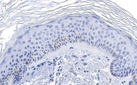 Anti-RXR-alpha Antibody, clone 2I8 ZooMAb® Rabbit Monoclonal recombinant, expressed in HEK 293 cells