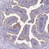 Anti-TMPRSS2 antibody produced in rabbit Prestige Antibodies® Powered by Atlas Antibodies, affinity isolated antibody, buffered aqueous glycerol solution