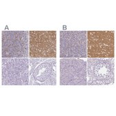 Anti-SLC17A7 antibody produced in rabbit Prestige Antibodies® Powered by Atlas Antibodies, affinity isolated antibody, buffered aqueous glycerol solution